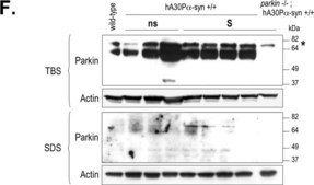 Anti-Parkin Antibody, clone PRK8 ascites fluid, clone PRK8, Chemicon®