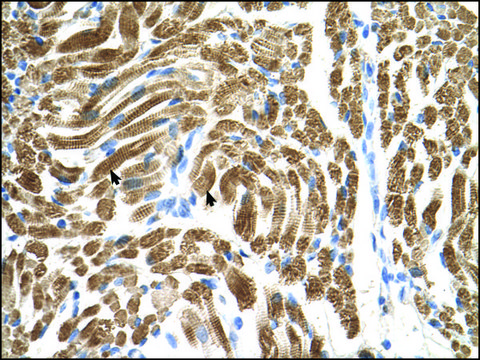 Anti-PEX10 (AB1) antibody produced in rabbit affinity isolated antibody