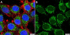 Anti-S100A12 Antibody, clone 1L6 ZooMAb® Rabbit Monoclonal recombinant, expressed in HEK 293 cells