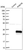 Anti-RAB27B antibody produced in rabbit Prestige Antibodies® Powered by Atlas Antibodies, affinity isolated antibody, buffered aqueous glycerol solution