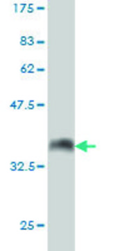 Monoclonal Anti-ATP2A1 antibody produced in mouse clone 6F8, purified immunoglobulin, buffered aqueous solution