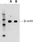 mRNA Isolation Kit for Blood/Bone Marrow sufficient for 100 isolation(s) (5 mL), kit of for up to 30 (100) isolations from 5 mL (1.5 mL) sample volumes, suitable for RT-PCR, suitable for Northern blotting, suitable for ELISA