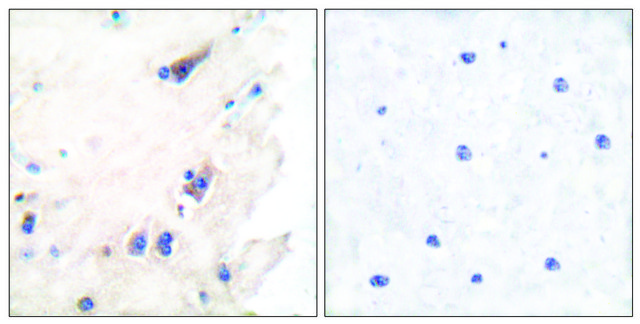 Anti-PLCB3 antibody produced in rabbit affinity isolated antibody