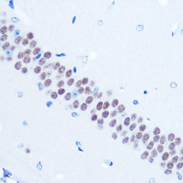 Anti-TLE1 antibody produced in rabbit