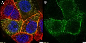 Anti-CFTR Antibody, clone MM13-4 ZooMAb® Mouse Monoclonal recombinant, expressed in HEK 293 cells