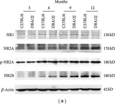 Anti-NR1 Antibody, CT Upstate&#174;, from mouse