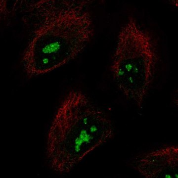 Anti-SMKR1 antibody produced in rabbit Prestige Antibodies&#174; Powered by Atlas Antibodies, affinity isolated antibody