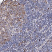Anti-RPL30 antibody produced in rabbit Prestige Antibodies® Powered by Atlas Antibodies, affinity isolated antibody, buffered aqueous glycerol solution
