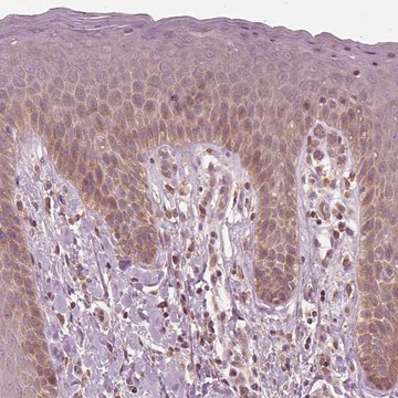 Anti-CNOT2 antibody produced in rabbit Prestige Antibodies&#174; Powered by Atlas Antibodies, affinity isolated antibody