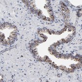 Anti-TXNRD2 antibody produced in rabbit Prestige Antibodies&#174; Powered by Atlas Antibodies, affinity isolated antibody, buffered aqueous glycerol solution