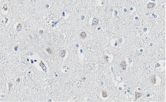 Anti-APP Antibody, clone 1F22 ZooMAb&#174; Rabbit Monoclonal recombinant, expressed in HEK 293 cells