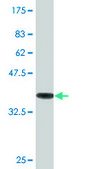 Monoclonal Anti-TUBA3, (C-terminal) antibody produced in mouse clone 2D2, purified immunoglobulin, buffered aqueous solution