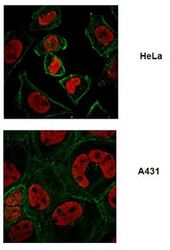 Anti-FUSE-binding protein 1 Antibody from rabbit, purified by affinity chromatography