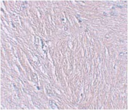 Anti-Synaptopodin Antibody from rabbit, purified by affinity chromatography