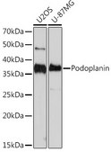 Anti-Podoplanin Antibody, clone 8I3I5, Rabbit Monoclonal