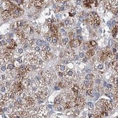 Anti-CLPB antibody produced in rabbit Prestige Antibodies® Powered by Atlas Antibodies, affinity isolated antibody, buffered aqueous glycerol solution