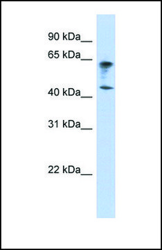 Anti-IGSF11 antibody produced in rabbit affinity isolated antibody