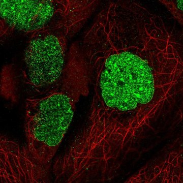 Anti-SUMO1 antibody produced in rabbit Prestige Antibodies&#174; Powered by Atlas Antibodies, affinity isolated antibody