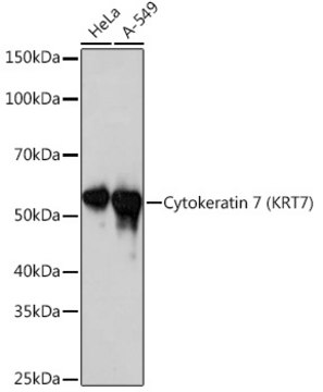 Anti-Cytokeratin 7 (KRT7) Antibody, clone 6Q1B4, Rabbit Monoclonal