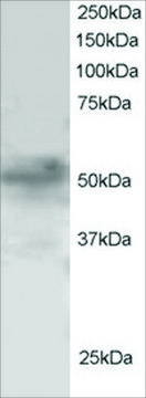 Anti-FOXQ1/FKHRL1 antibody produced in goat affinity isolated antibody, buffered aqueous solution