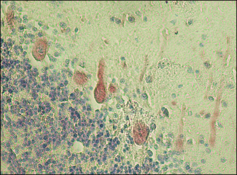 Anti-Neurofilament 200 (Phos and Non-Phos) antibody, Mouse monoclonal clone N52, purified from hybridoma cell culture