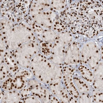 Anti-KIAA0141 antibody produced in rabbit Prestige Antibodies&#174; Powered by Atlas Antibodies, affinity isolated antibody, buffered aqueous glycerol solution