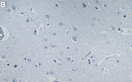 Anti-FXR1 Antibody, clone 1L9 ZooMAb&#174; Rabbit Monoclonal recombinant, expressed in HEK 293 cells