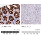 Anti-LGALS4 antibody produced in rabbit Prestige Antibodies® Powered by Atlas Antibodies, affinity isolated antibody, buffered aqueous glycerol solution