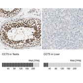 Anti-CCT5 antibody produced in rabbit Prestige Antibodies® Powered by Atlas Antibodies, affinity isolated antibody, buffered aqueous glycerol solution