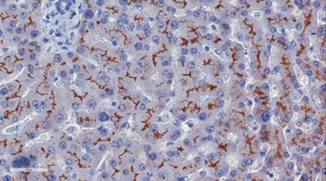 Anti-ABCB11 Antibody, clone 10D4.1 clone 10D4.1, from mouse