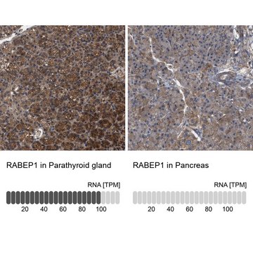 Anti-RABEP1 antibody produced in rabbit Prestige Antibodies&#174; Powered by Atlas Antibodies, affinity isolated antibody, buffered aqueous glycerol solution, Ab1