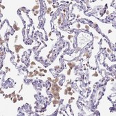 Anti-CR1 antibody produced in rabbit Prestige Antibodies® Powered by Atlas Antibodies, affinity isolated antibody, buffered aqueous glycerol solution