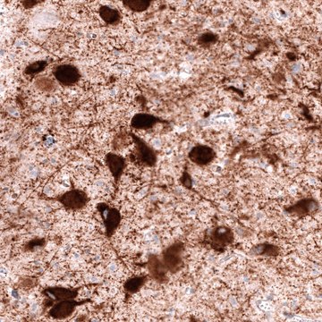 Anti-SLC18A2 antibody produced in mouse Prestige Antibodies&#174; Powered by Atlas Antibodies, clone CL12531, purified by using Protein A, buffered aqueous glycerol solution