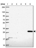 Anti-CLIC2 antibody produced in rabbit Prestige Antibodies® Powered by Atlas Antibodies, affinity isolated antibody, buffered aqueous glycerol solution