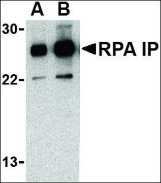 Anti-RPA Interacting Protein (ab2) antibody produced in rabbit affinity isolated antibody, buffered aqueous solution