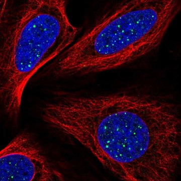 Anti-TINF2 antibody produced in rabbit Prestige Antibodies&#174; Powered by Atlas Antibodies, affinity isolated antibody