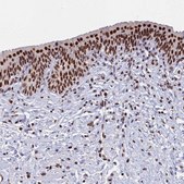Anti-MOSPD3 antibody produced in rabbit Prestige Antibodies® Powered by Atlas Antibodies, affinity isolated antibody, buffered aqueous glycerol solution