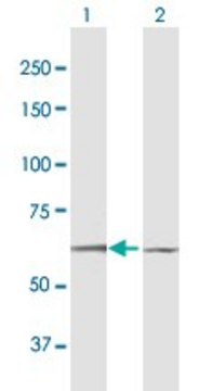 Anti-DYRK1B antibody produced in mouse purified immunoglobulin, buffered aqueous solution