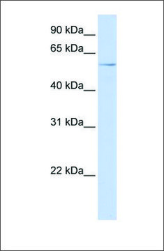 Anti-RIPK3 antibody produced in rabbit affinity isolated antibody, lyophilized powder