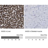 抗-AASS 兔抗 Prestige Antibodies® Powered by Atlas Antibodies, affinity isolated antibody, buffered aqueous glycerol solution, Ab2
