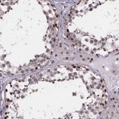 Anti-U2SURP antibody produced in rabbit Prestige Antibodies® Powered by Atlas Antibodies, affinity isolated antibody
