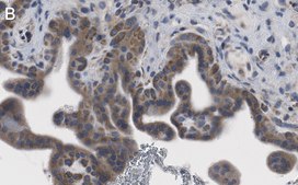 Anti-ZCCHC3 Antibody, clone 1E10 ZooMAb® Rabbit Monoclonal recombinant, expressed in HEK 293 cells