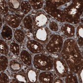 Monoclonal Anti-CARS antibody produced in mouse Prestige Antibodies® Powered by Atlas Antibodies, clone CL2310, purified immunoglobulin, buffered aqueous glycerol solution