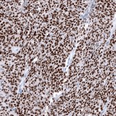 Anti-WT1 antibody produced in mouse Prestige Antibodies® Powered by Atlas Antibodies, clone CL13176, purified by using Protein A, buffered aqueous glycerol solution