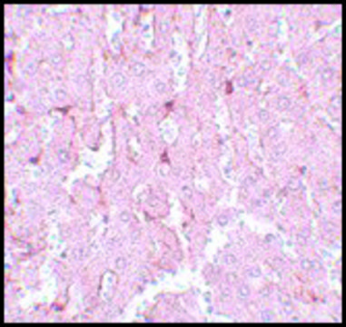 Anti-LXR-A antibody produced in rabbit affinity isolated antibody, buffered aqueous solution