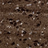 Anti-PDP1 antibody produced in rabbit Prestige Antibodies® Powered by Atlas Antibodies, affinity isolated antibody, buffered aqueous glycerol solution