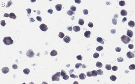 Anti-RSV Fusion Protein Antibody, clone 131-2A ZooMAb® Mouse Monoclonal recombinant, expressed in HEK 293 cells