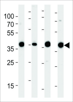 ANTI-ALDOLASE (ALDOA)(N-TERMINAL) antibody produced in rabbit purified immunoglobulin, buffered aqueous solution