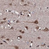 Anti-CSTF3 antibody produced in rabbit Prestige Antibodies® Powered by Atlas Antibodies, affinity isolated antibody, buffered aqueous glycerol solution