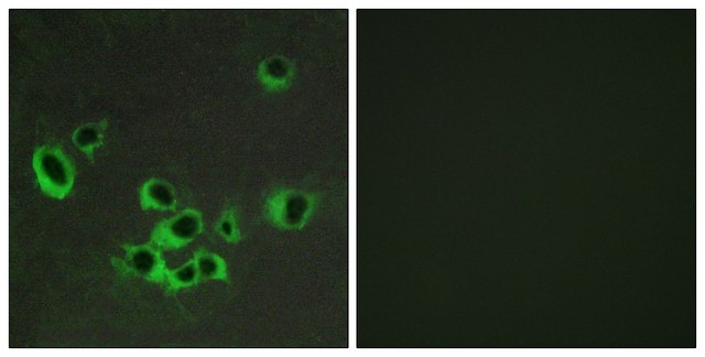 Anti-HTR2B antibody produced in rabbit affinity isolated antibody